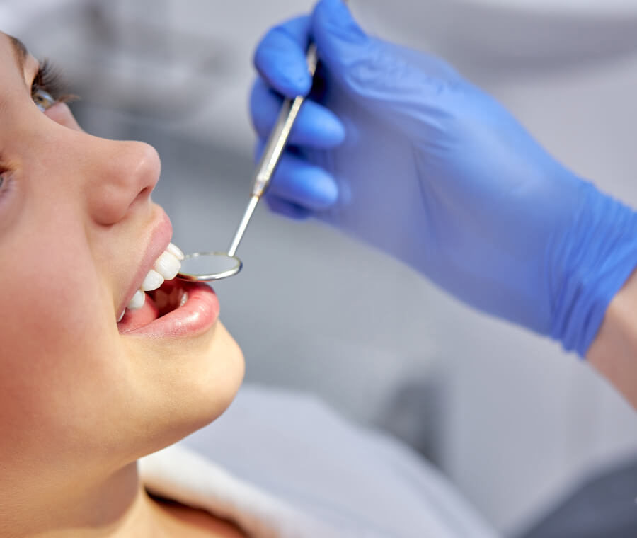 Dental Sealants