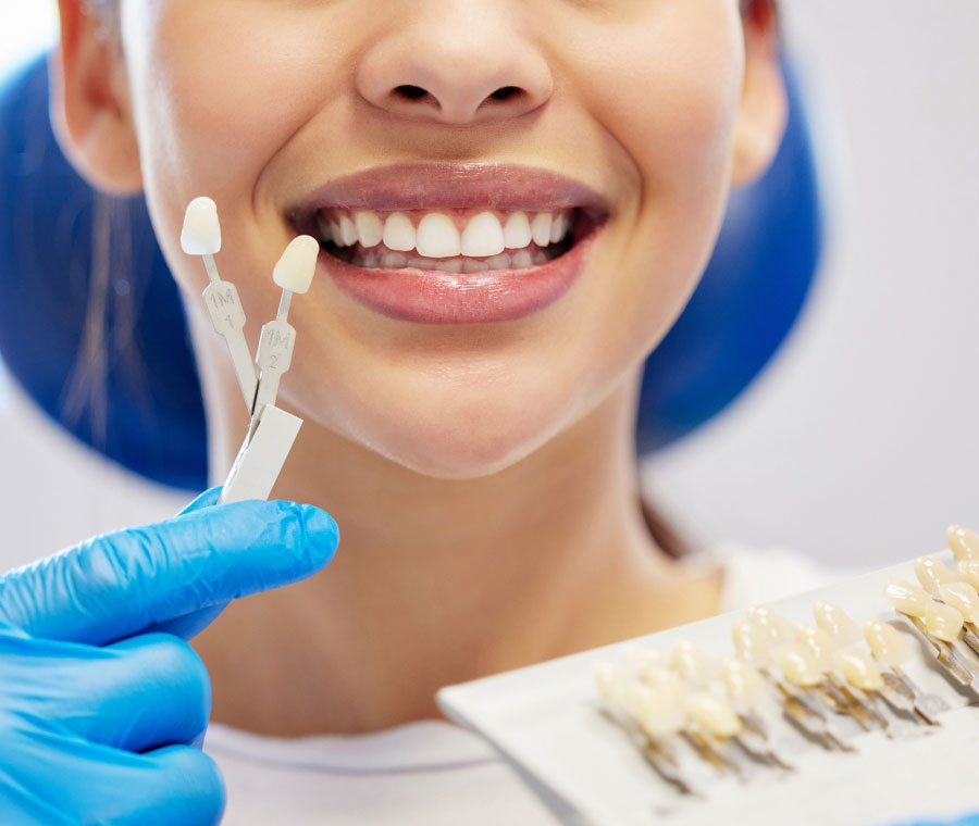 Veneers Are the Right Choice for You