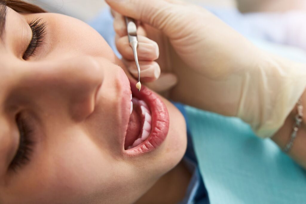Young woman with her mouth open, ready for a dental filling, while a dentist holds a plugger
