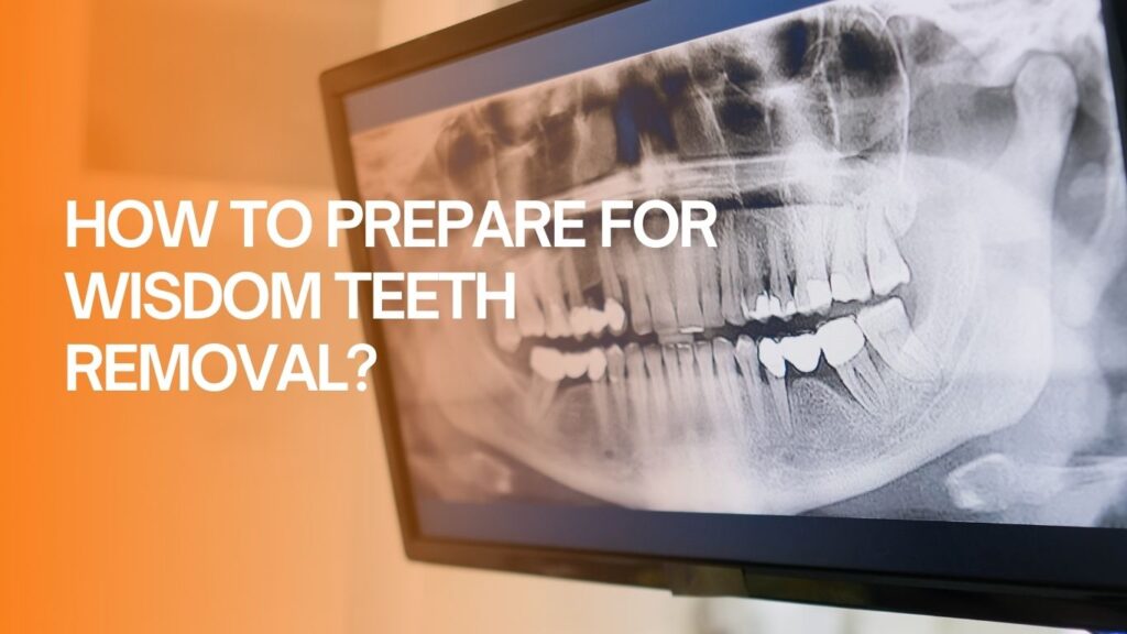 How to prepare for wisdom teeth removal?
