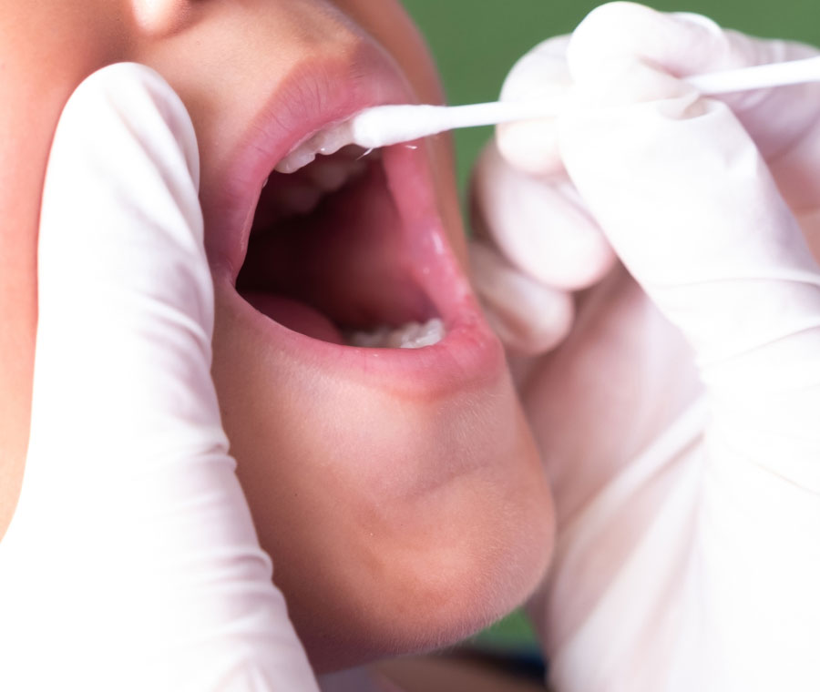 Boost Your Defenses with Fluoride Treatment