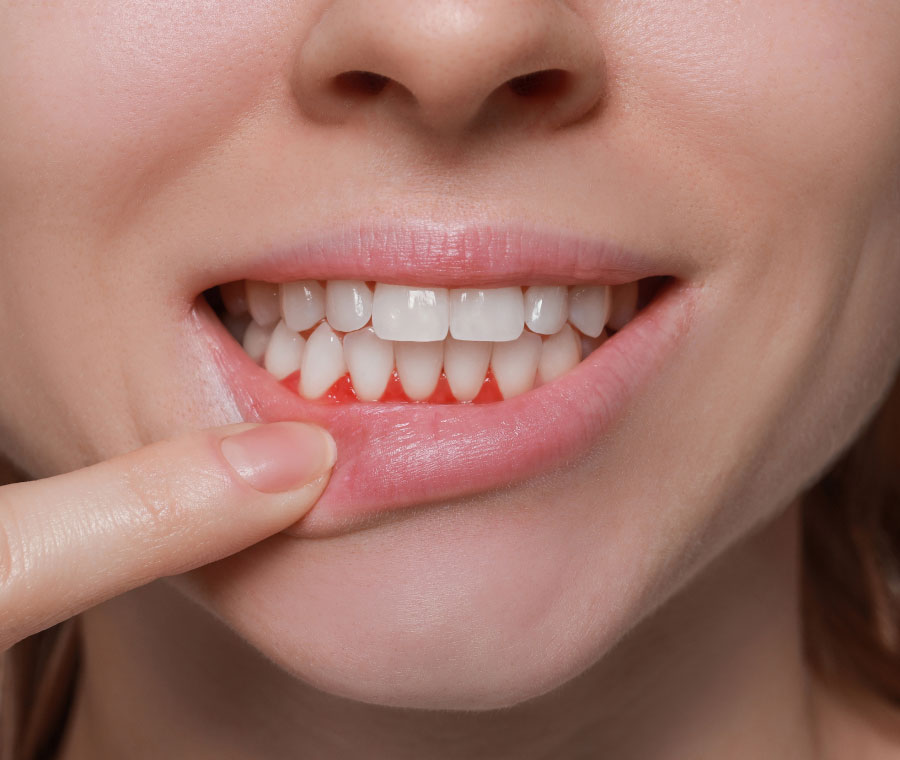 Are Your Gums at Risk?