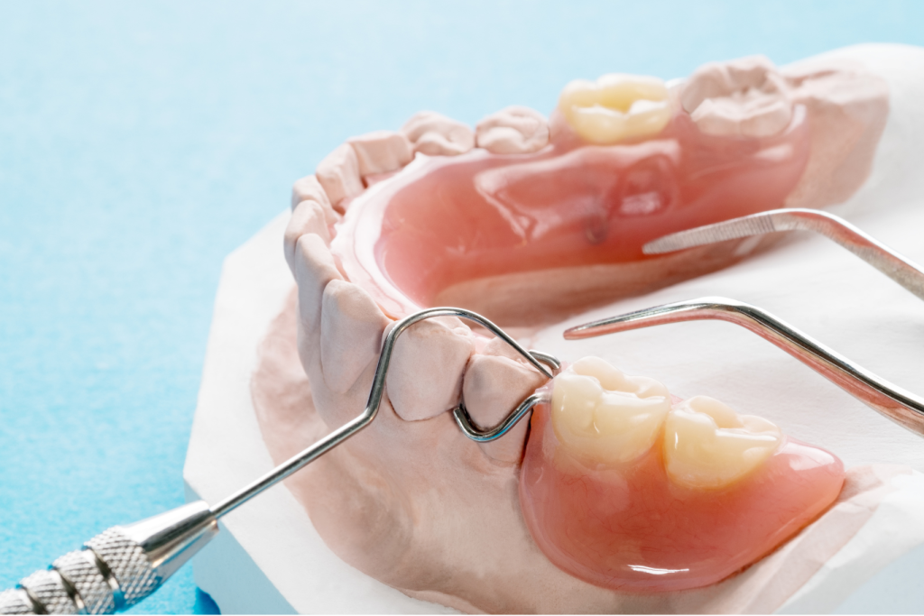 Close-up of an artificial removable partial denture or temporary partial denture on blue background