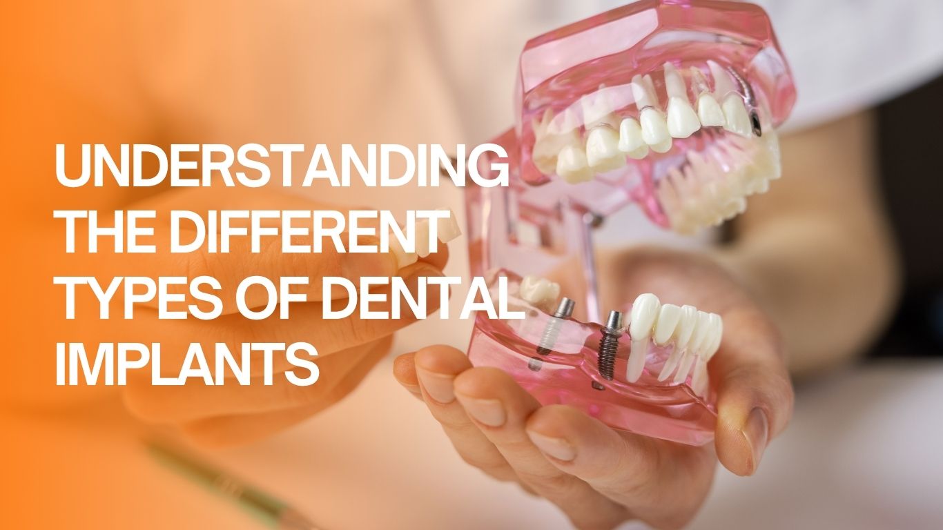 Close up of a hand holding a typodont with dental implants